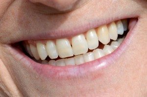 Lanita Medina RN, Smiles (Close Up)