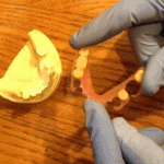 Flexing a valplast partial denture.