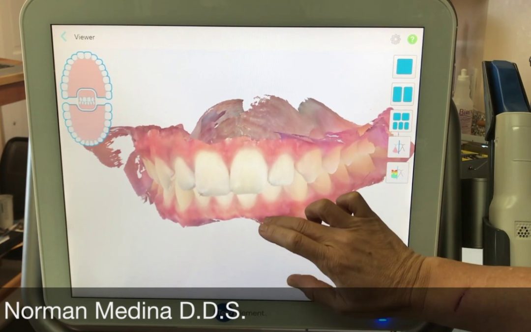 What is a Dental Health Scan? Do I have one in my dental records?