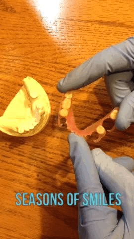 Partial Dentures