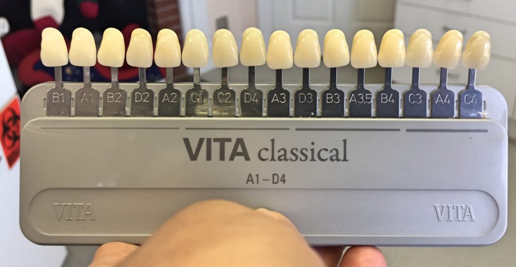 Vita Shade Guide Lightest to Darkest - Tools to whiten my teeth.